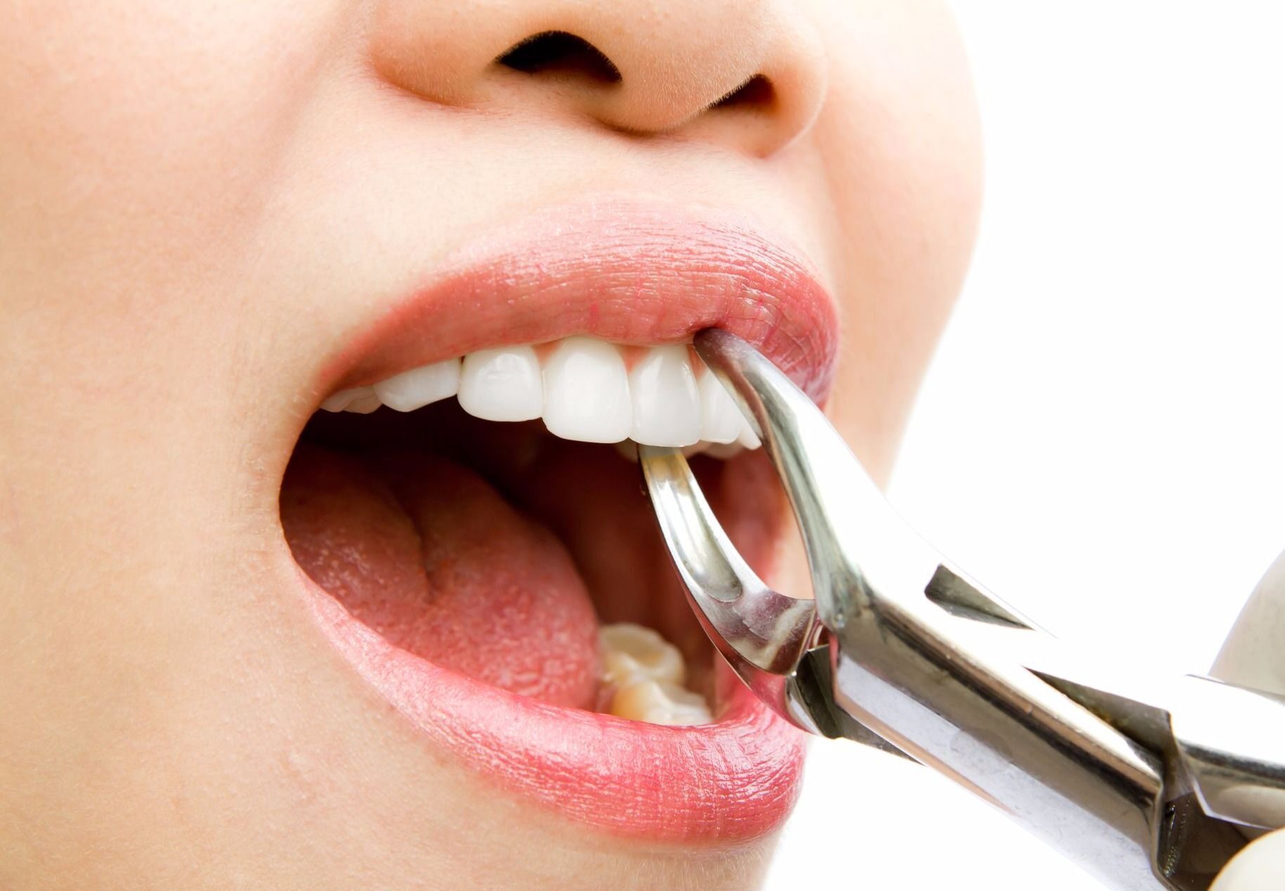 О чем думают стоматологи, когда смотрят на ваши зубы?